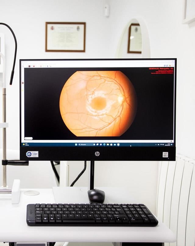 En Óptica Cambre, tu salud visual es nuestra prioridad