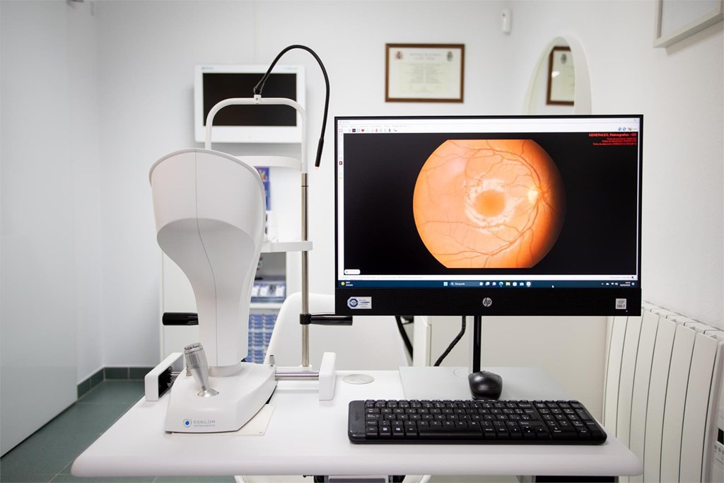 LA RETINA: LA VENTANA AL MUNDO QUE A VECES SE APAGA