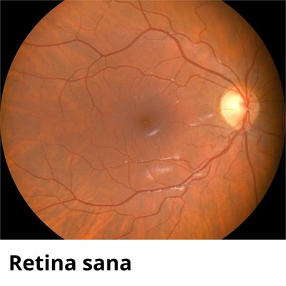 LA RETINA: LA VENTANA AL MUNDO QUE A VECES SE APAGA - Imagen 1